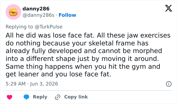 Man Reveals Dramatic 80-Day Transformation After Daily Jaw Exercises Man Reveals Dramatic 80-Day Transformation After Daily Jaw Exercises