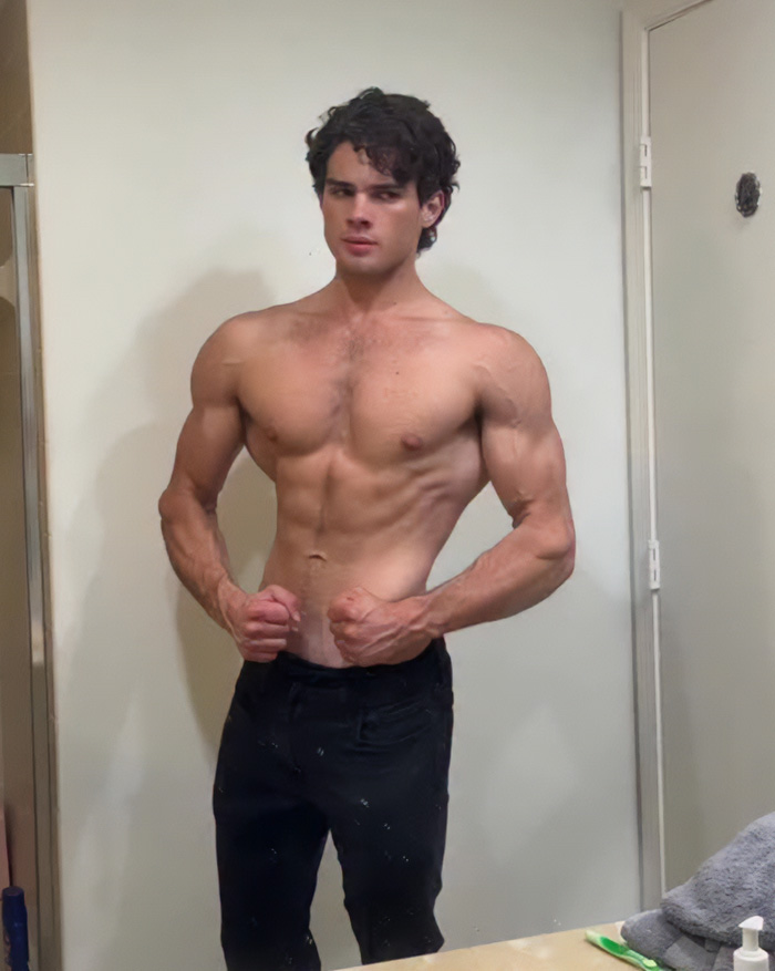 Looksmaxxer Clavicular Shows Off His Nose Job Before-And-After, And Fans Are Worried He “Ruined His Face” Looksmaxxer Clavicular Shows Off His Nose Job Before-And-After, And Fans Are Worried He “Ruined His Face”
