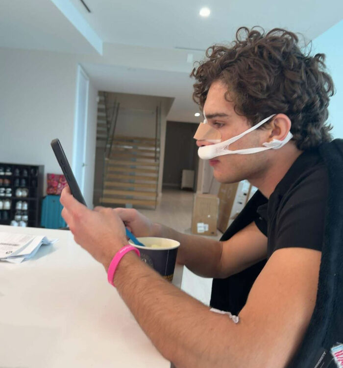 Looksmaxxer Clavicular Shows Off His Nose Job Before-And-After, And Fans Are Worried He “Ruined His Face” Looksmaxxer Clavicular Shows Off His Nose Job Before-And-After, And Fans Are Worried He “Ruined His Face”