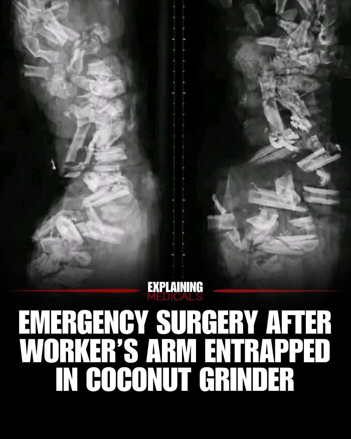&ldquo;The Patient Has 81 Teeth&rdquo;: 61 Facts About Health And The Human Body That Show Just How Strange We Really Are