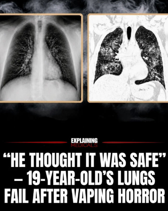 &ldquo;The Patient Has 81 Teeth&rdquo;: 61 Facts About Health And The Human Body That Show Just How Strange We Really Are