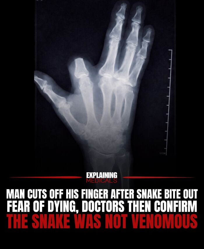 &ldquo;The Patient Has 81 Teeth&rdquo;: 61 Facts About Health And The Human Body That Show Just How Strange We Really Are
