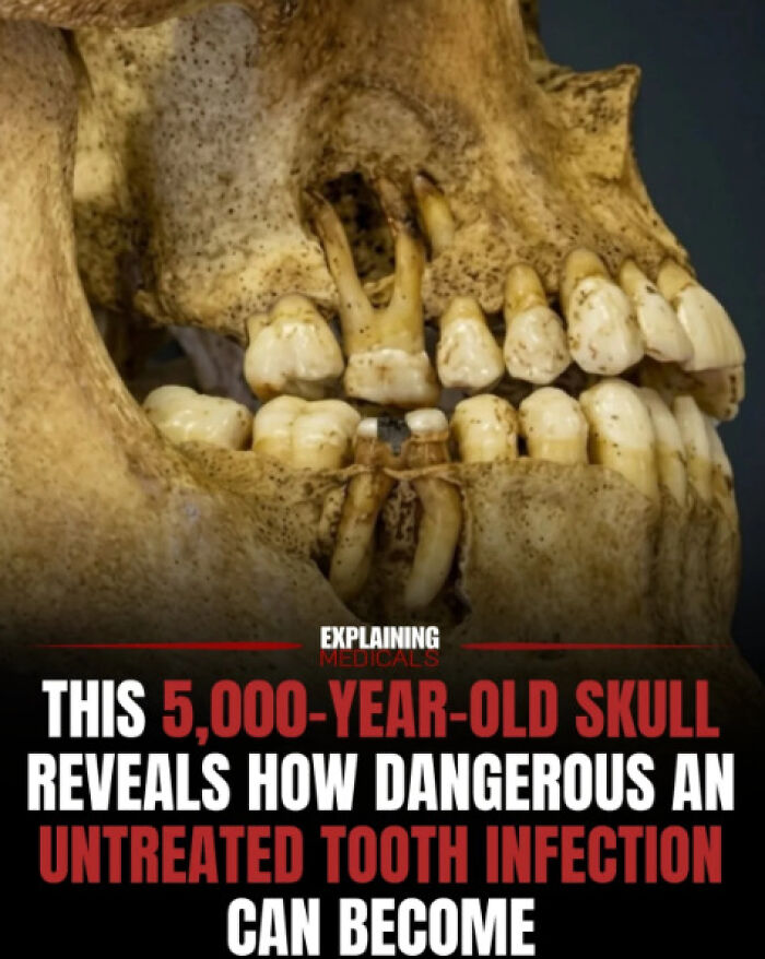 &ldquo;The Patient Has 81 Teeth&rdquo;: 61 Facts About Health And The Human Body That Show Just How Strange We Really Are