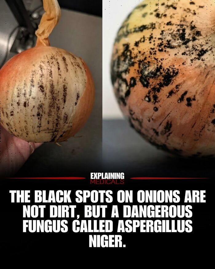 &ldquo;The Patient Has 81 Teeth&rdquo;: 61 Facts About Health And The Human Body That Show Just How Strange We Really Are