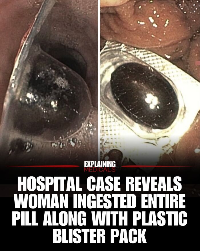 &ldquo;The Patient Has 81 Teeth&rdquo;: 61 Facts About Health And The Human Body That Show Just How Strange We Really Are