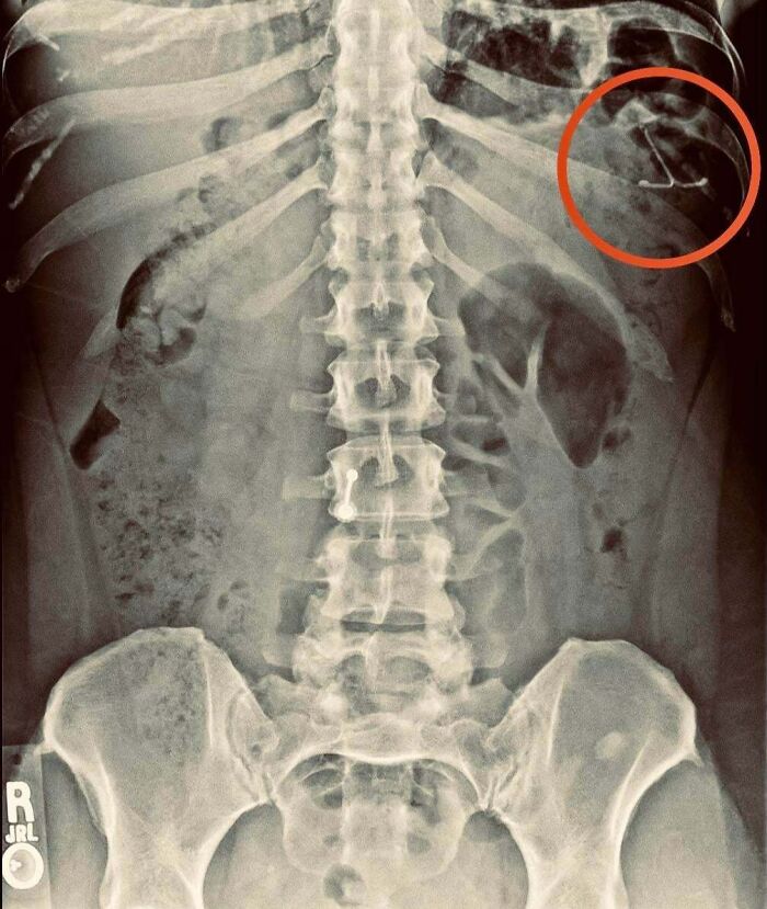 56 Real-Life Plot Twists That People Would Never Believe If They Didn’t Actually Happen
