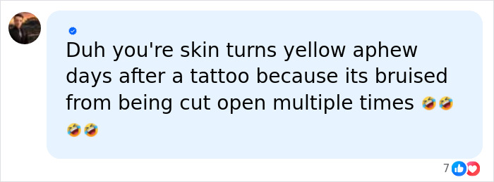 Machine Gun Kelly Reveals Frightening Side Effects Of Covering Body In Tattoo Ink, Doctors Unveil The Dangers