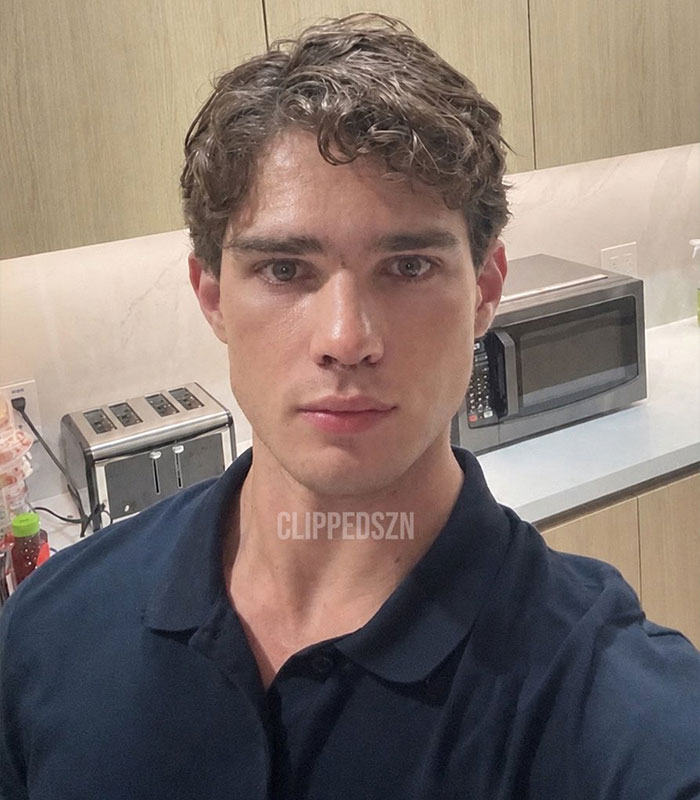 “Looksmaxxing” Attempt By Clavicular Torn Down By Netizens After He Shared Side-By-Side Results