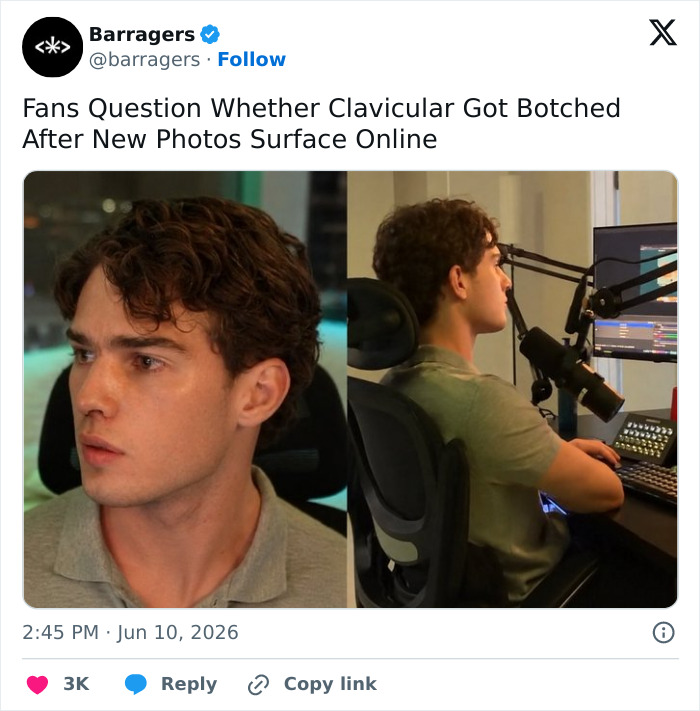 “Looksmaxxing” Attempt By Clavicular Torn Down By Netizens After He Shared Side-By-Side Results