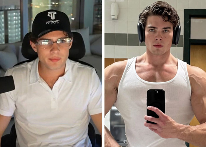 “Looksmaxxing” Attempt By Clavicular Torn Down By Netizens After He Shared Side-By-Side Results