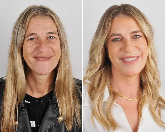 10 Jaw-Dropping Before-And-After Collages Of Women Who Underwent Extensive Smile Makeovers 10 Jaw-Dropping Before-And-After Collages Of Women Who Underwent Extensive Smile Makeovers
