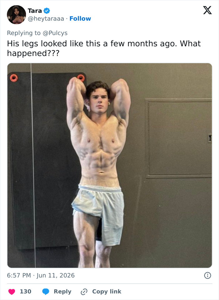 Looksmaxxer Clavicular Just Had His 3rd Surgery, And People Are Getting Concerned About His Transformation Looksmaxxer Clavicular Just Had His 3rd Surgery, And People Are Getting Concerned About His Transformation