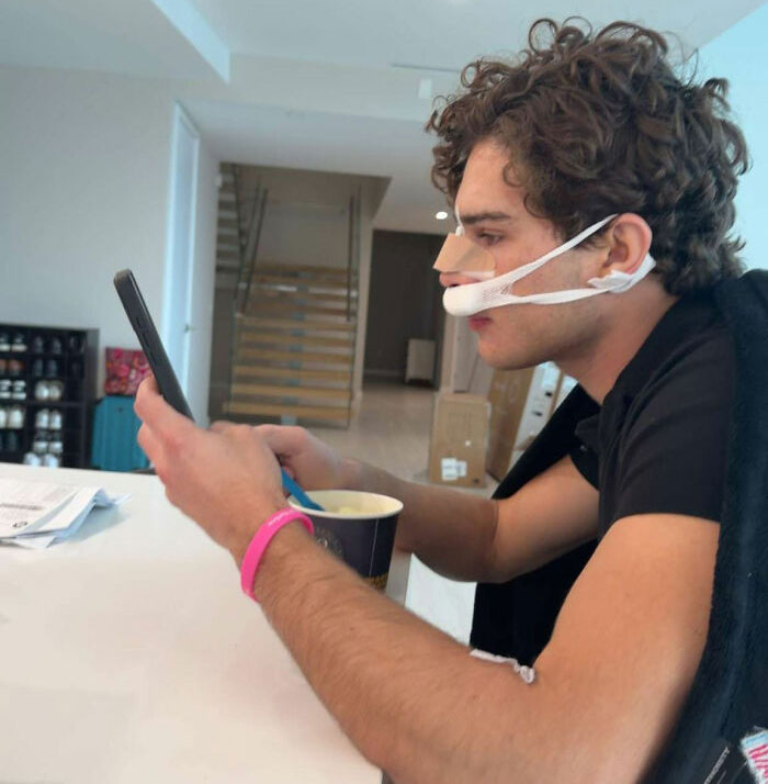 Looksmaxxer Clavicular Just Had His 3rd Surgery, And People Are Getting Concerned About His Transformation Looksmaxxer Clavicular Just Had His 3rd Surgery, And People Are Getting Concerned About His Transformation