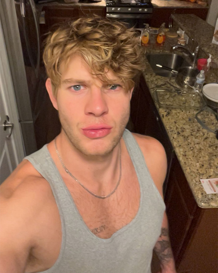 Doctor Warns Of The Risks After “Looksmaxxer” Films Himself Using A Maxilla Expander Doctor Warns Of The Risks After “Looksmaxxer” Films Himself Using A Maxilla Expander
