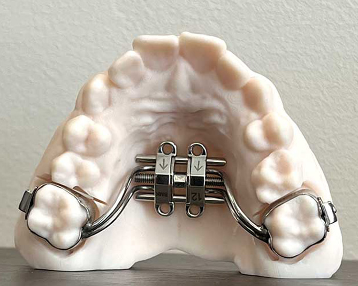 Doctor Warns Of The Risks After “Looksmaxxer” Films Himself Using A Maxilla Expander Doctor Warns Of The Risks After “Looksmaxxer” Films Himself Using A Maxilla Expander