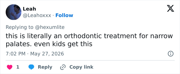 Doctor Warns Of The Risks After “Looksmaxxer” Films Himself Using A Maxilla Expander Doctor Warns Of The Risks After “Looksmaxxer” Films Himself Using A Maxilla Expander