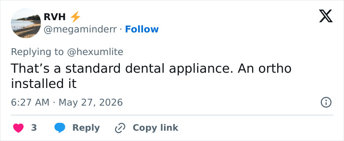 Doctor Warns Of The Risks After “Looksmaxxer” Films Himself Using A Maxilla Expander Doctor Warns Of The Risks After “Looksmaxxer” Films Himself Using A Maxilla Expander