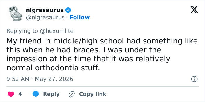 Doctor Warns Of The Risks After “Looksmaxxer” Films Himself Using A Maxilla Expander Doctor Warns Of The Risks After “Looksmaxxer” Films Himself Using A Maxilla Expander