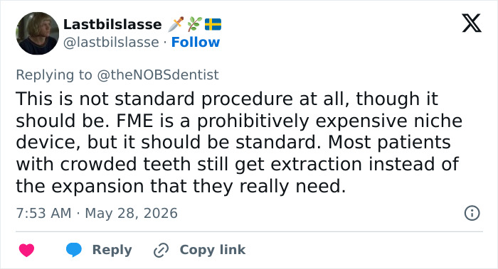 Doctor Warns Of The Risks After “Looksmaxxer” Films Himself Using A Maxilla Expander Doctor Warns Of The Risks After “Looksmaxxer” Films Himself Using A Maxilla Expander