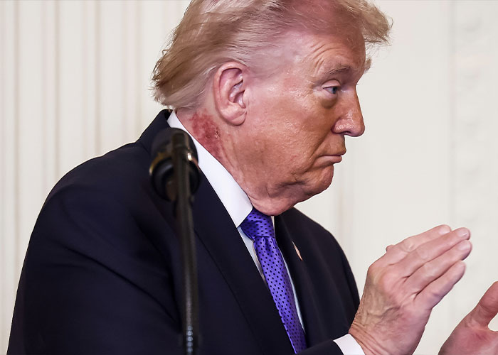 Trump Health Mystery Deepens As New Filing Reveals Surprising Number Of Specialists Involved In President’s Care