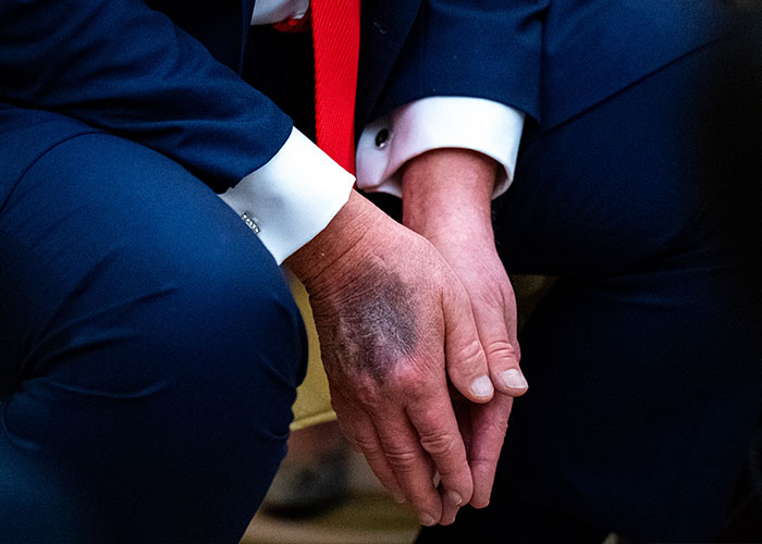 Trump Health Mystery Deepens As New Filing Reveals Surprising Number Of Specialists Involved In President’s Care