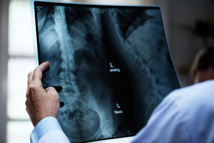 Girlfriend Breaks Her Back, Homophobic Parents Leave The Couple To Handle Everything Alone