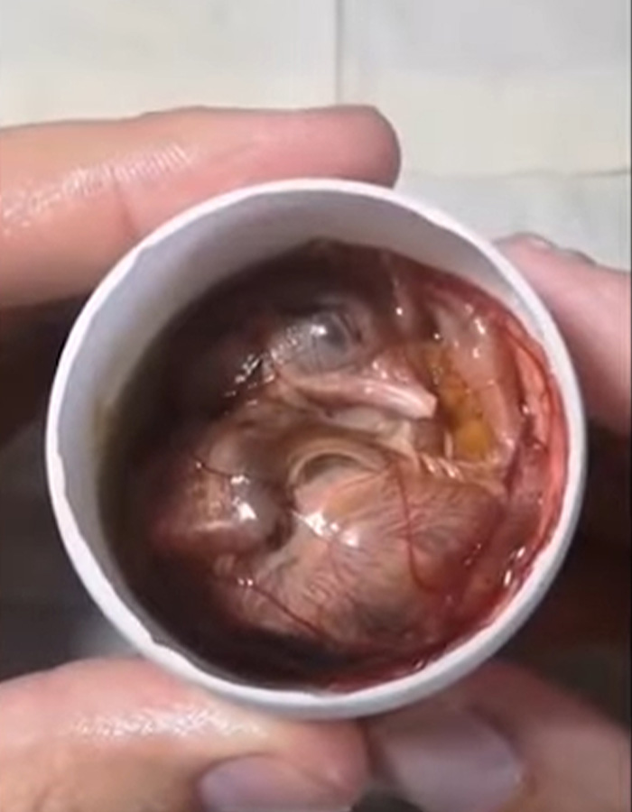 “Quite Horrifying”: Man Successfully Grows A Chicken In An Open Egg And Gets It On Video “Quite Horrifying”: Man Successfully Grows A Chicken In An Open Egg And Gets It On Video