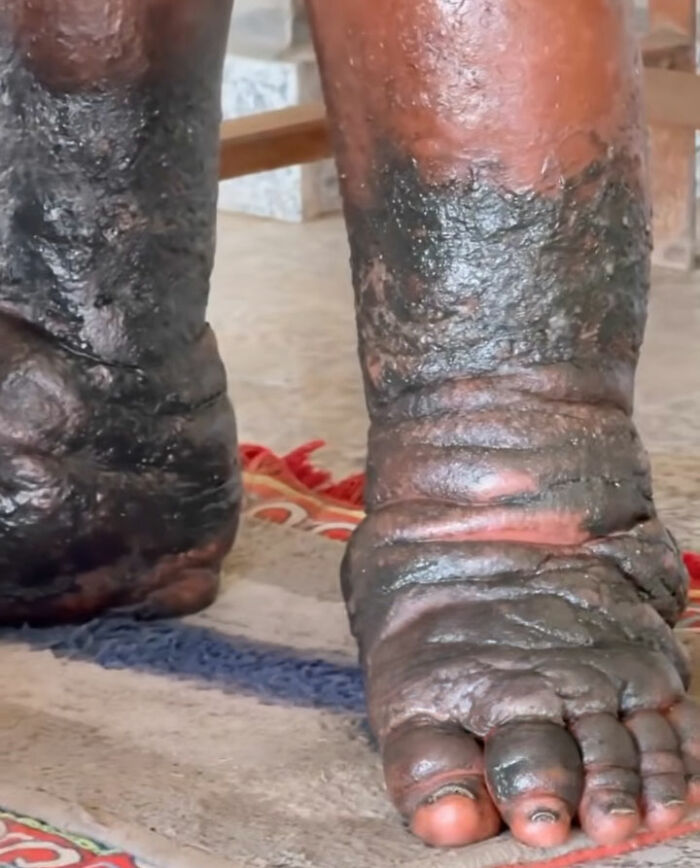 Man Stands In The Same Place For 12 Years As A Vow To God Shiva As Details Of Penance Disturb Netizens Man Stands In The Same Place For 12 Years As A Vow To God Shiva As Details Of Penance Disturb Netizens