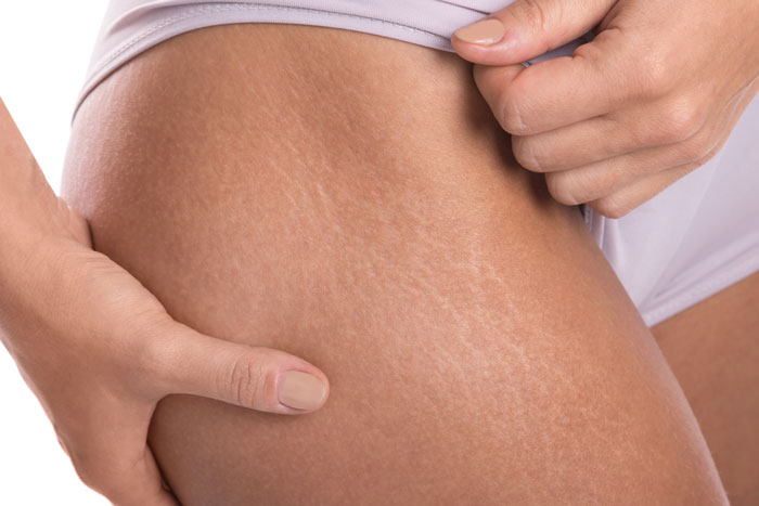 “Still Not Sure If That Was A Dig Or A Compliment”: 56 Unhinged Comments Women Received About Their Bodies “Still Not Sure If That Was A Dig Or A Compliment”: 56 Unhinged Comments Women Received About Their Bodies