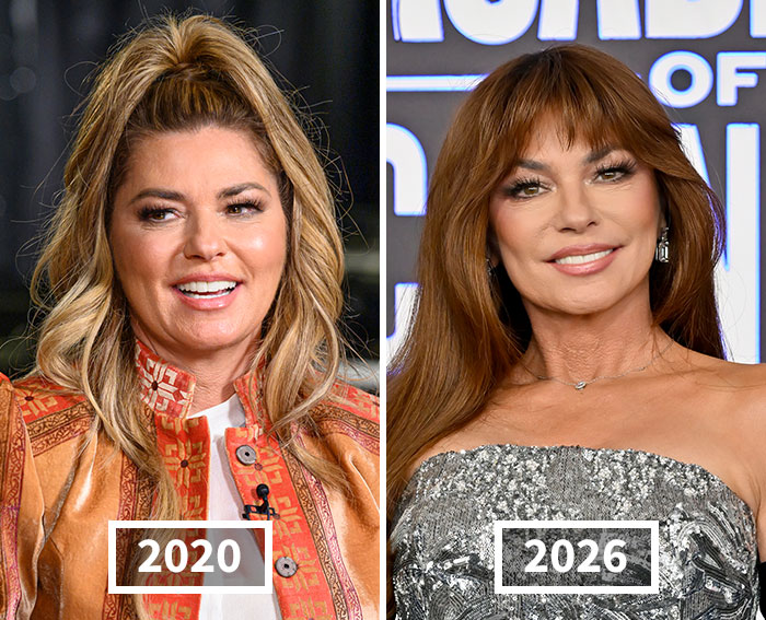 After Trying To Conform To Beauty Standards, Shania Twain Reveals Terrifying Side Effects Of Her Transformation After Trying To Conform To Beauty Standards, Shania Twain Reveals Terrifying Side Effects Of Her Transformation