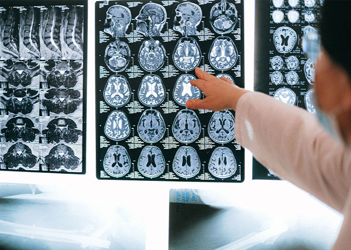 New Research Pinpoints Hidden Brain Trigger That Causes Autism, Changing How We Understand The Condition New Research Pinpoints Hidden Brain Trigger That Causes Autism, Changing How We Understand The Condition