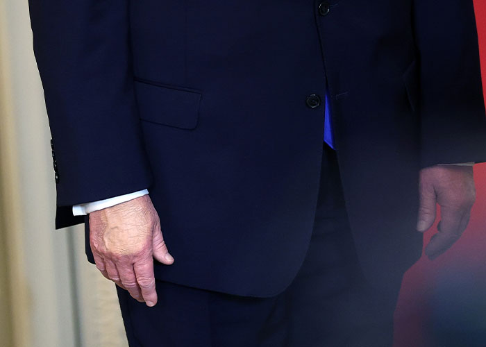 Leaked G7 Photos Spur Trump Health Concerns After Viewers Spot Bruises, Deep Gash Leaked G7 Photos Spur Trump Health Concerns After Viewers Spot Bruises, Deep Gash