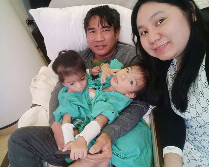 2-Year-Old Conjoined Twins Successfully Separated Following Grueling Six-Hour Surgery 2-Year-Old Conjoined Twins Successfully Separated Following Grueling Six-Hour Surgery