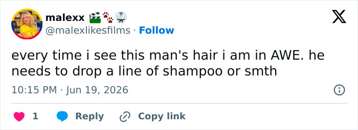 Norwegian Soccer Star’s Hair Sparks Hilarious Comparisons As Fans Demand To Know His Hair Care Secrets Norwegian Soccer Star’s Hair Sparks Hilarious Comparisons As Fans Demand To Know His Hair Care Secrets