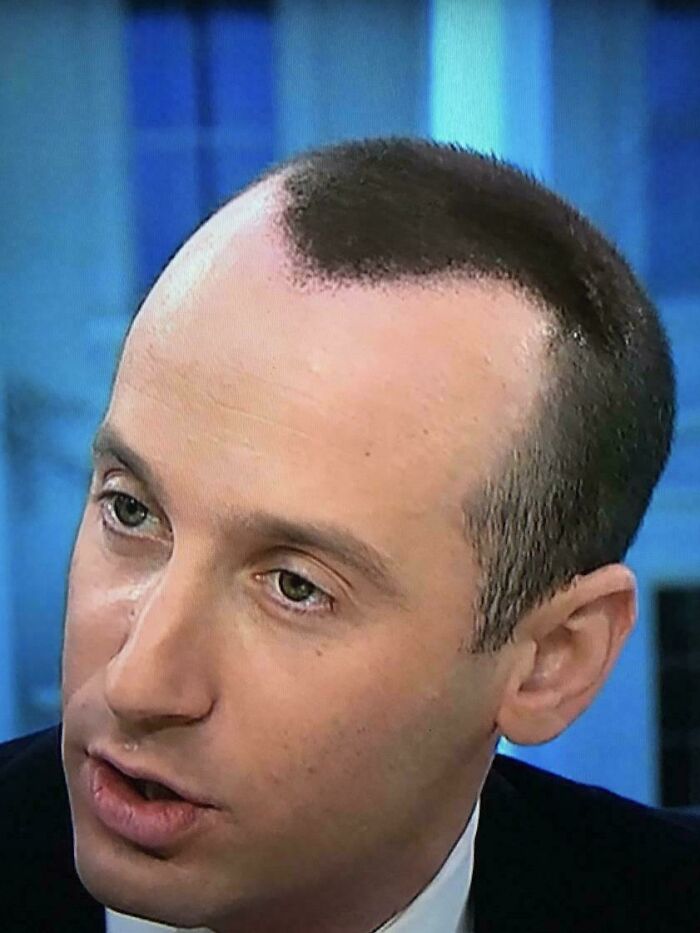 This Community Shares Unfortunate Haircuts, And Here Are 84 Of The Worst Ones (New Pics) This Community Shares Unfortunate Haircuts, And Here Are 84 Of The Worst Ones (New Pics)
