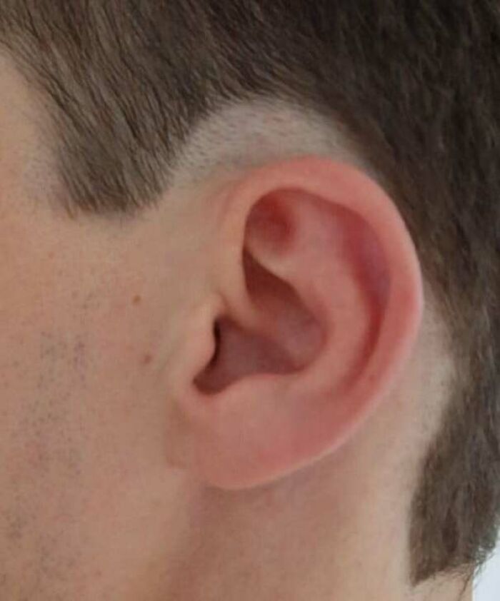 This Community Shares Unfortunate Haircuts, And Here Are 84 Of The Worst Ones (New Pics) This Community Shares Unfortunate Haircuts, And Here Are 84 Of The Worst Ones (New Pics)