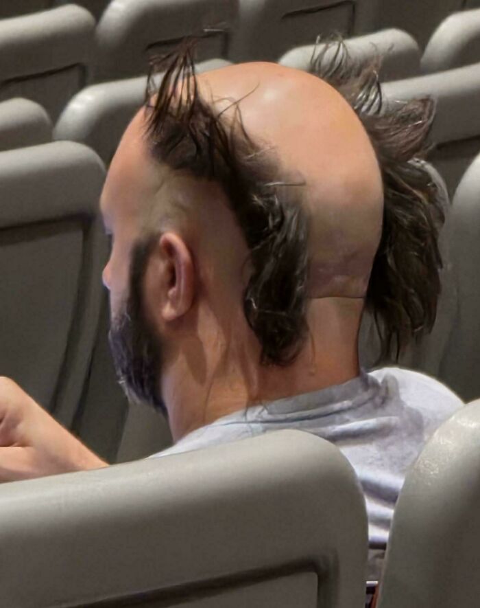 This Community Shares Unfortunate Haircuts, And Here Are 84 Of The Worst Ones (New Pics) This Community Shares Unfortunate Haircuts, And Here Are 84 Of The Worst Ones (New Pics)