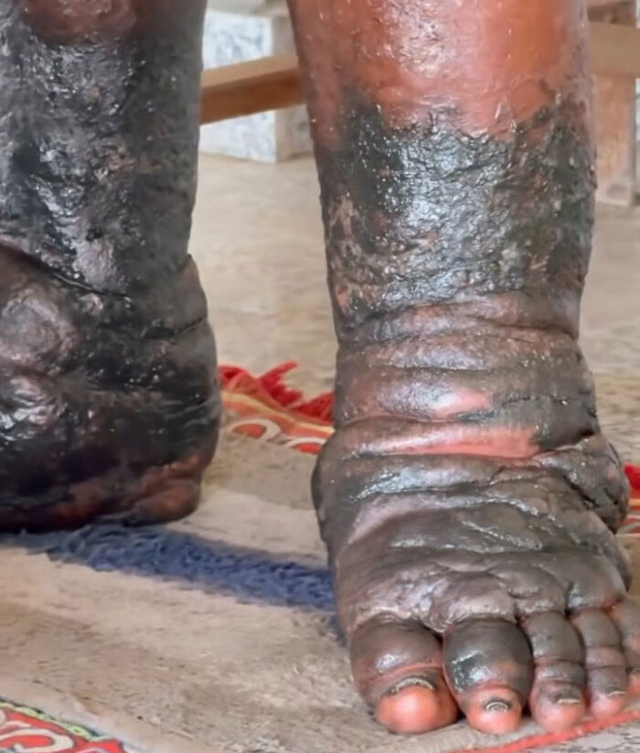 Man Standing For Over 5 Years In Extreme Act Of Devotion Stuns Netizens, Expert Explains The Ritual Man Standing For Over 5 Years In Extreme Act Of Devotion Stuns Netizens, Expert Explains The Ritual