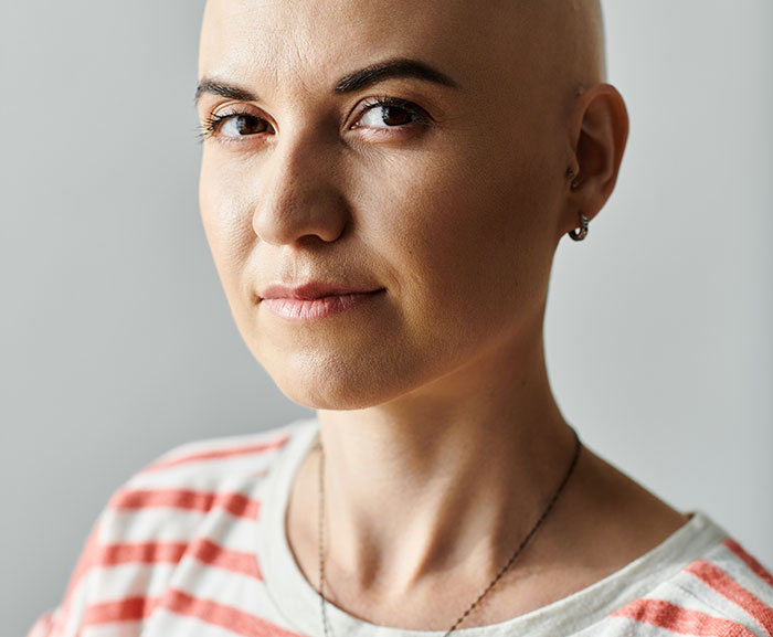 Couple Gets Annoyed That SIL With Cancer Is Taking Away From Their Wedding, It’s Way Worse Than That Couple Gets Annoyed That SIL With Cancer Is Taking Away From Their Wedding, It’s Way Worse Than That