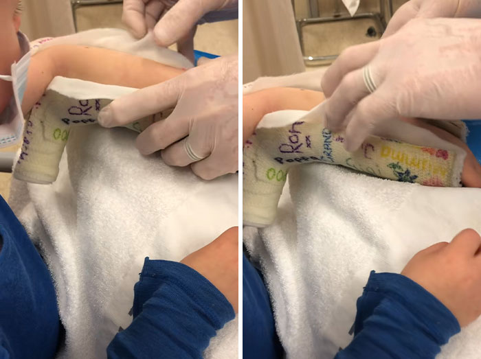 Doctor Discovers Jaw‑Dropping Surprise Hidden In Four‑Year‑Old Boy&rsquo;s Plaster Cast