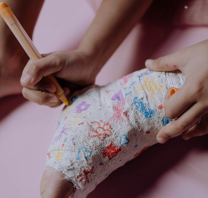 Doctor Discovers Jaw‑Dropping Surprise Hidden In Four‑Year‑Old Boy&rsquo;s Plaster Cast