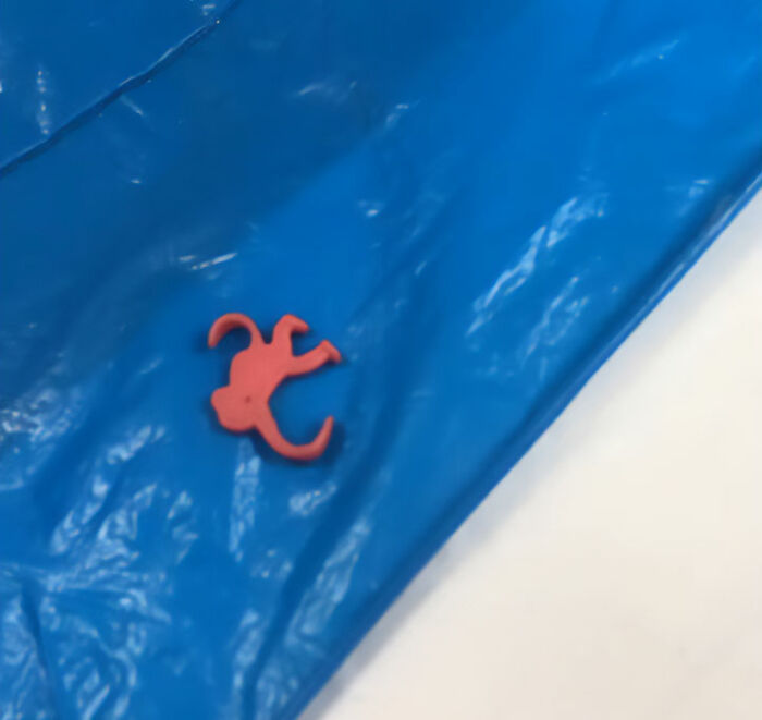 Doctor Discovers Jaw‑Dropping Surprise Hidden In Four‑Year‑Old Boy&rsquo;s Plaster Cast