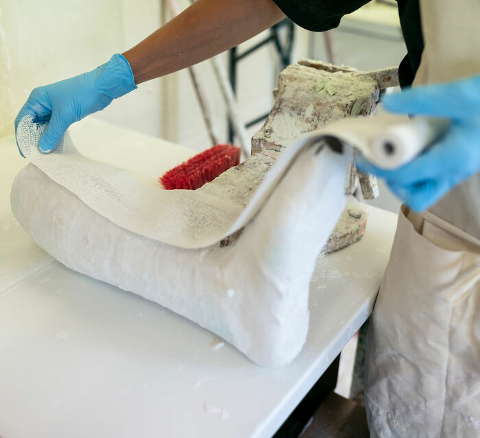 Doctor Discovers Jaw‑Dropping Surprise Hidden In Four‑Year‑Old Boy&rsquo;s Plaster Cast