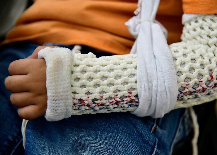 Doctor Discovers Jaw‑Dropping Surprise Hidden In Four‑Year‑Old Boy&rsquo;s Plaster Cast