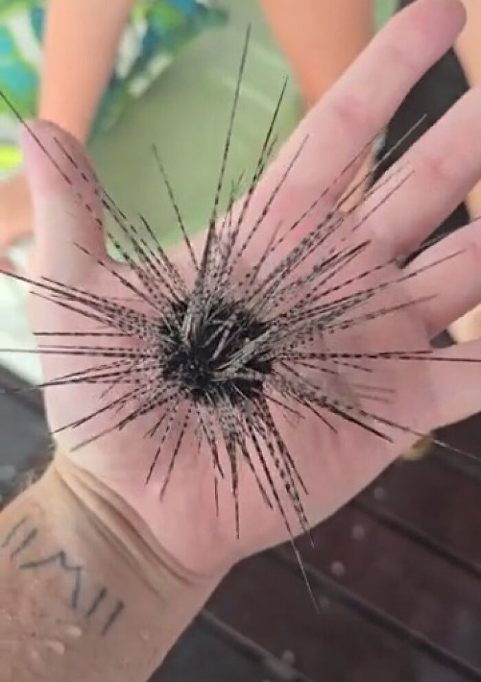 “WHY WOULD YOU TOUCH THAT?!”: 71 Things That Should Really Be Left Alone