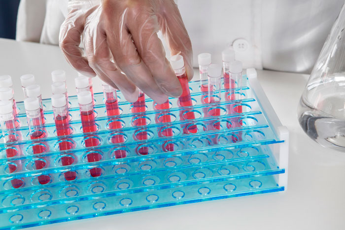 &ldquo;I Never Thought This Would Happen To Me&rdquo;: 34 DNA Testing Stories That Revealed More Than People Expected