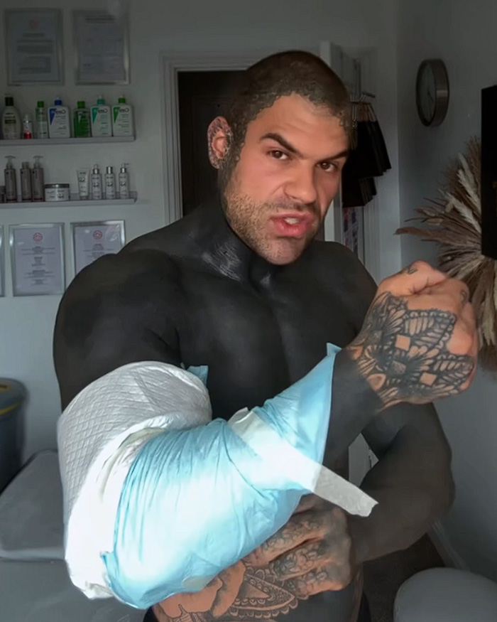 Man Covered In Blackout Tattoos Reveals Harsh Truths He Wishes He&rsquo;d Known Before Diving Into The Trend