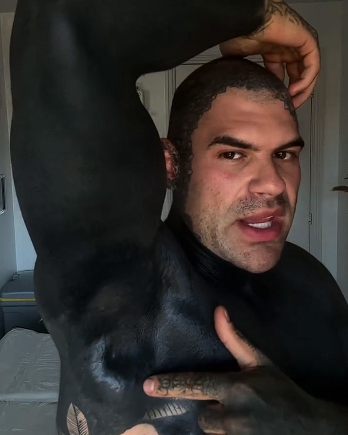 Man Covered In Blackout Tattoos Reveals Harsh Truths He Wishes He&rsquo;d Known Before Diving Into The Trend