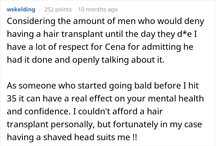 John Cena Shocks With Hair Transplant Reveal After Being Caught Having Trouble Walking