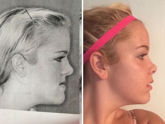 90 Mildly Interesting Before-And-After Photos That Show Just How Much Things Can Change